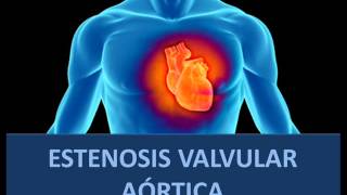 Estenosis valvular aórtica  Fisiopatología [upl. by Narrat]