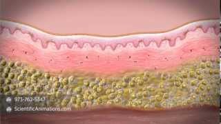 What is stem cell therapy [upl. by Sayers]