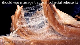 Myofascial release vs massage Chiropractor explains fascia [upl. by Bromleigh]