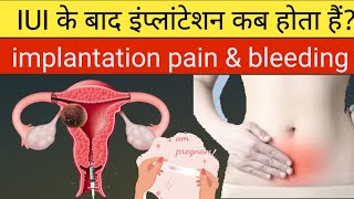 iui ke bad implantation kab hota hai implantation symptoms in hindiiui [upl. by Veta867]