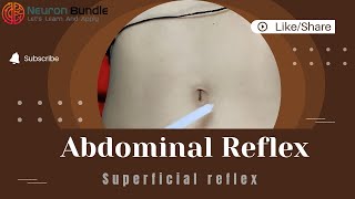 Mastering Superficial Abdominal reflex  Normal amp Absent reflex umnlesion reflexes [upl. by Sydelle54]