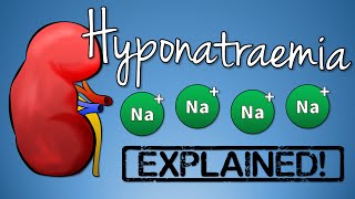 Hyponatremia EXPLAINED with Animation [upl. by Nnairrek]