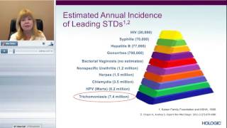 The Most Common STI Trichomonas Vaginalis TV [upl. by Marmion606]