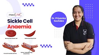 Sickle Cell Anaemia  Pathogenesis  Factors  Diagnosis by DR Priyanka Sachdev  MedLive [upl. by Gravante]