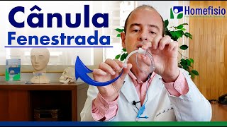 Como funciona e para que serve uma Cânula Fenestrada de Traqueostomia [upl. by Duong]