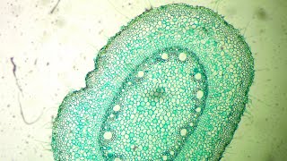 Monocot Stem Under the Microscope [upl. by Gillett]