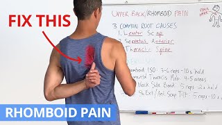 How to Fix Upper Back  Rhomboid Pain for GOOD 4 Effective Exercises [upl. by Ohploda908]