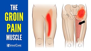 The Groin Pain Muscle How to Release It for INSTANT RELIEF [upl. by Ahsercel]