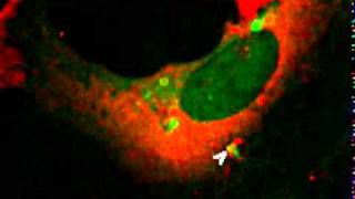 Autophagy Protects against Sindbis Virus Infection of the Central Nervous System [upl. by Eerehc762]