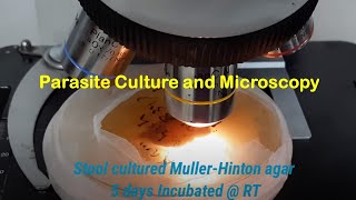 Parasite Culture and Microscopy [upl. by Ainos]