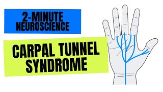 2Minute Neuroscience Carpal Tunnel Syndrome [upl. by O'Reilly]