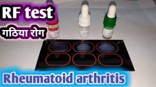 RF agglutination test  Rheumatoid arthritis test  गठिया रोग का जाँच और लक्षण । [upl. by Ujawernalo]