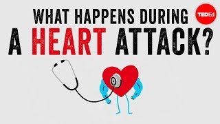 What happens during a heart attack  Krishna Sudhir [upl. by Arimat119]