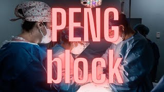 Podcast PENG Block  Pericapsular Nerve Group Block  2024 [upl. by Neiviv309]