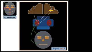 Neurology Examination MRCP PACES Lecture 9 Hemiplegia part 2 [upl. by Oskar]