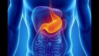 What is Dyspepsia What causes Dyspepsia Symptoms and Treatment of Indigestion [upl. by Lema15]