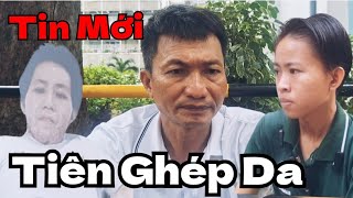 Tin Mới Tiên Ghép Da [upl. by Meg142]