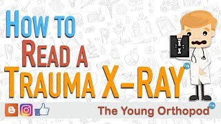 How to Read an X RAY Trauma Radiograph  The Young Orthopod [upl. by Ennobe]