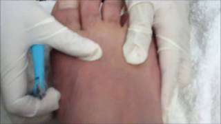 pedicura para hombres paso a paso [upl. by Adnwahsal1]