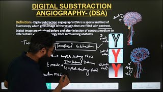 DSA  DIGITAL SUBTRACTION ANGIOGRAPHY  PRINCIPLE PART1 TYPE OF DSA  IN HINDI  MADE EASY [upl. by Ednarb]