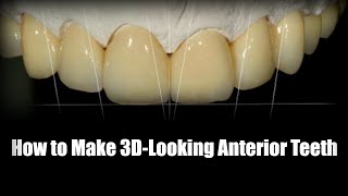 How to Make 3Dimensional Looking Anterior Teeth [upl. by Sheila]