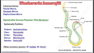 Wuchereria Filarial Worm [upl. by Olonam]