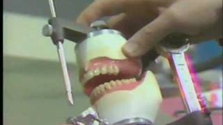 Posterior Teeth  Balanced Occlusion [upl. by Lillith]