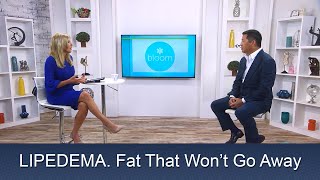 Lipedema Liposuction Surgery  In the News NBC Bloom  Lipo 360° Legs  Cure  Expert Dr Thomas Su [upl. by Jesh699]