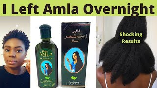 I Used Amla Oil On My Natural Hair Overnight and I Got Shocking Results [upl. by Rushing50]