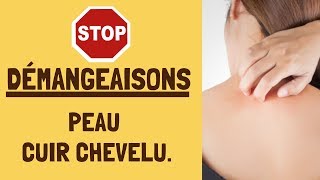 Démangeaisons peau ou cuir chevelu  Voici mes solutions avec les huiles essentielles [upl. by Mosenthal]