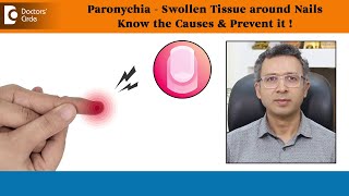 SWOLLEN TISSUE around NailsPARONYCHIACauses Prevention amp TreatmentDrNischal K CDoctors Circle [upl. by Mhoj616]