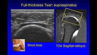 Musculoskeletal ultrasound [upl. by Yraillih]