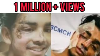 SteeveJosephAfter Accident Heart touching Video❤️ steevejoseph accident malluboy viral [upl. by Li]