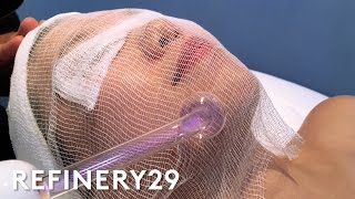 High Frequency Facial For Clear Skin  Beauty With Mi  Refinery29 [upl. by Ludeman]