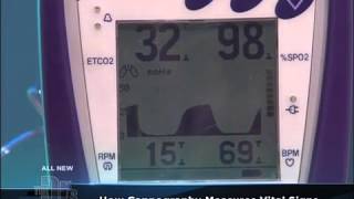 Capnography Medical Course [upl. by Lorelie]