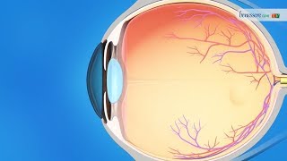 Le malattie oculari nellanziano riconoscere e curare glaucoma retinopatia degenerazione maculare [upl. by Lanaj]