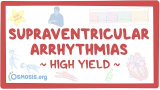 Supraventricular arrhythmias Pathology review [upl. by Gerius745]