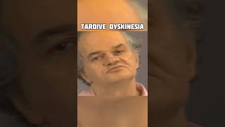 Tardive Dyskinesia [upl. by Edrock239]