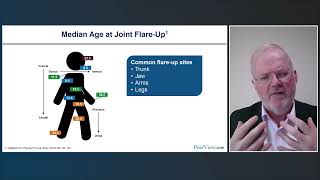 Can YOU Avoid Iatrogenic Harm Understanding and Identifying Fibrodysplasia Ossificans Progressiva [upl. by Ainimreh939]