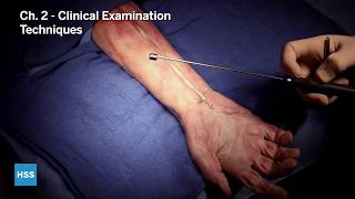 Palmaris Longus Tendon Part 2 Clinical Examination Techniques [upl. by Rehctaht]