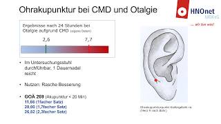 HNOnet NRW für HNOÄrzte Ohrakupunktur bei CMD und Otalgie [upl. by Anselm53]