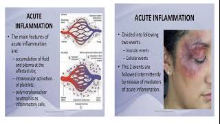 Inflammation  Contraction And Retraction Of Endothelial Cells  Dr Sana Khalid [upl. by Gracia]