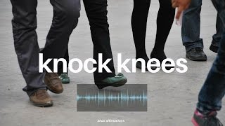 Correct Knock Knees  Perfect Leg Alignment―∎ affirmations [upl. by Samau]