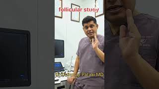 Size of egg during follicular study  DrChinmay Pataki  Isha Womens Hospital [upl. by Ramin]