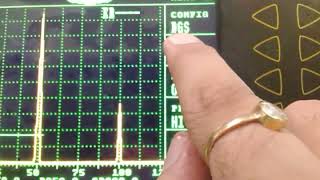 DGS Calibration using Backwall Echo [upl. by Alvita793]