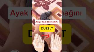 fizyoterapi doktor fizyoterapist hallux physiotherapy [upl. by Smoot]