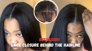 HOW TO LACE CLOSURE BEHIND THE HAIRLINE 💁🏾‍♀️ [upl. by Engamrahc]