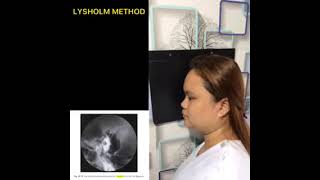 PETROUSMASTOID HENSCHEN SCHULLER LYSHOLM METHOD AXIOLATERAL PROJECTION [upl. by Annabela]