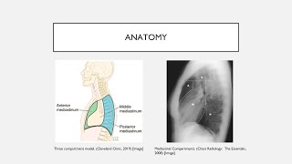 Mediastinal Masses [upl. by Ariahs]