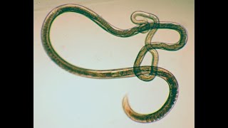 Trichuris Trichiura Whipworm  Causes Trichuriasis Symptoms Diagnosis Treatment [upl. by Elaval]